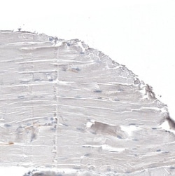 Jagged 2 Antibody, Novus Biologicals 0.1mL; Unlabeled:Antibodies, Polyclonal